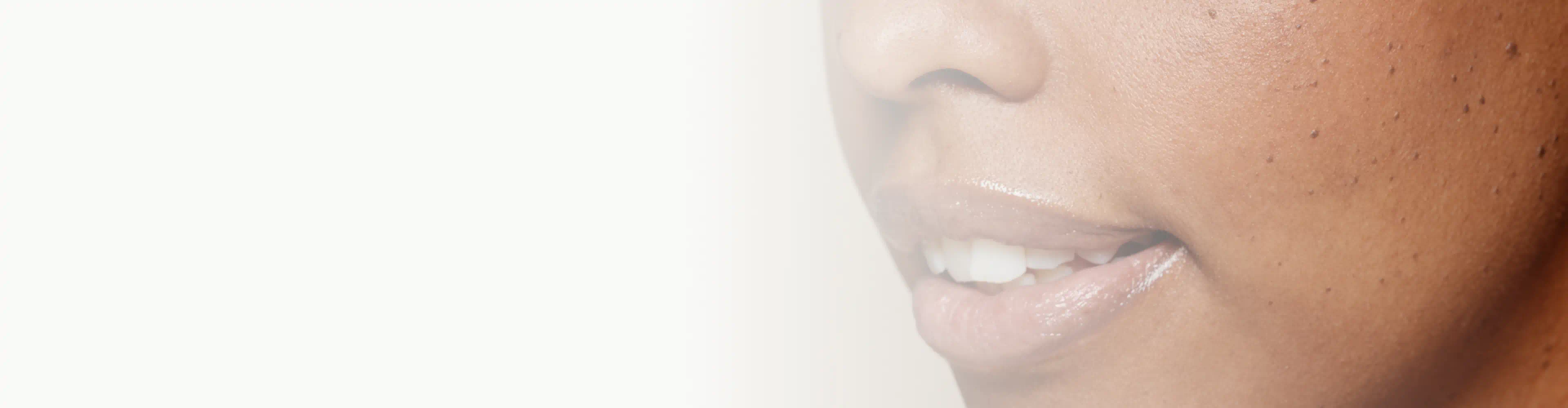 Person's cheek showing natural skin texture with visible pores and dark spots
