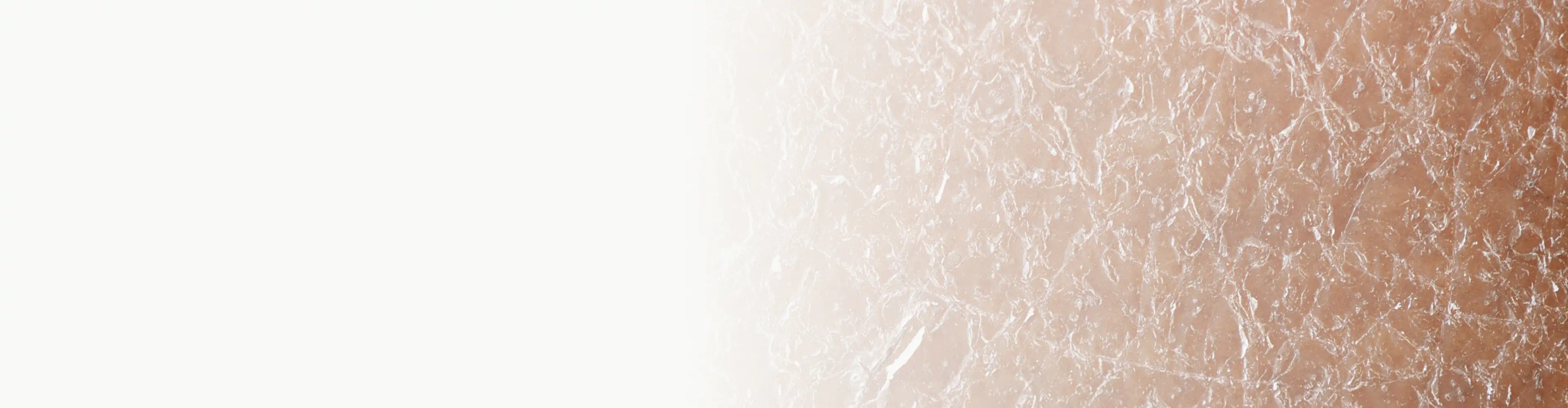 Detailed view of dry, cracked skin with a textured appearance
