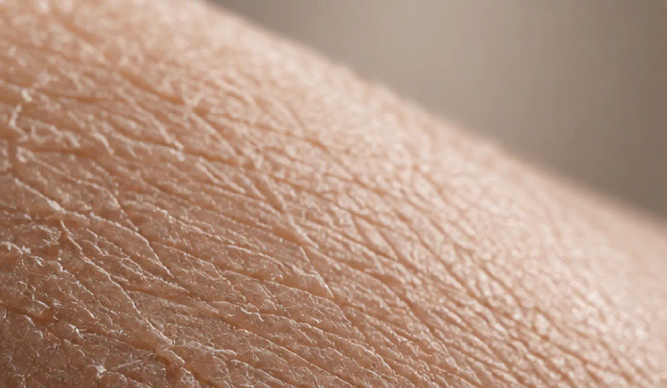 Close-up of dry skin texture without Peptide Fusion