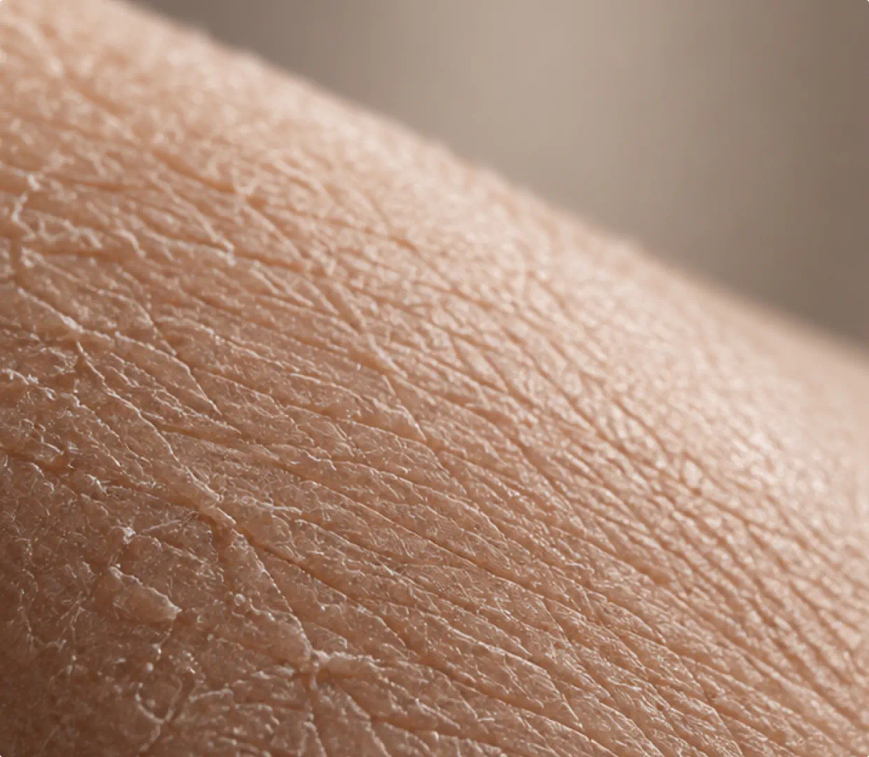 Close-up of dry skin texture without Peptide Fusion