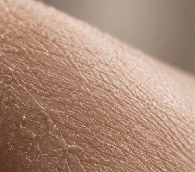 Close-up of dry skin texture without Peptide Fusion