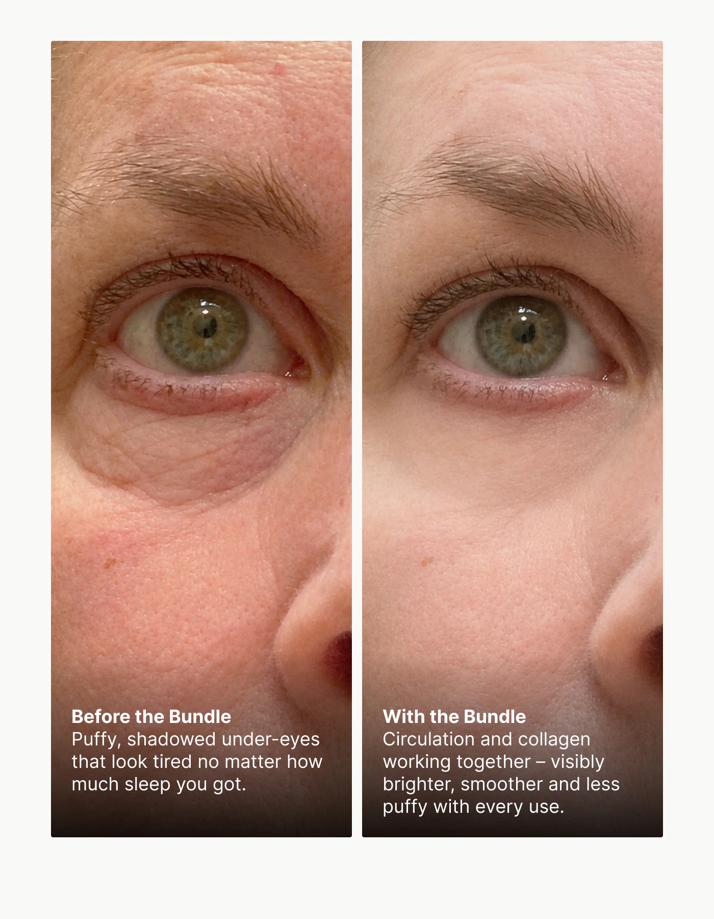Before and after comparison for brighter, less puffy under-eyes