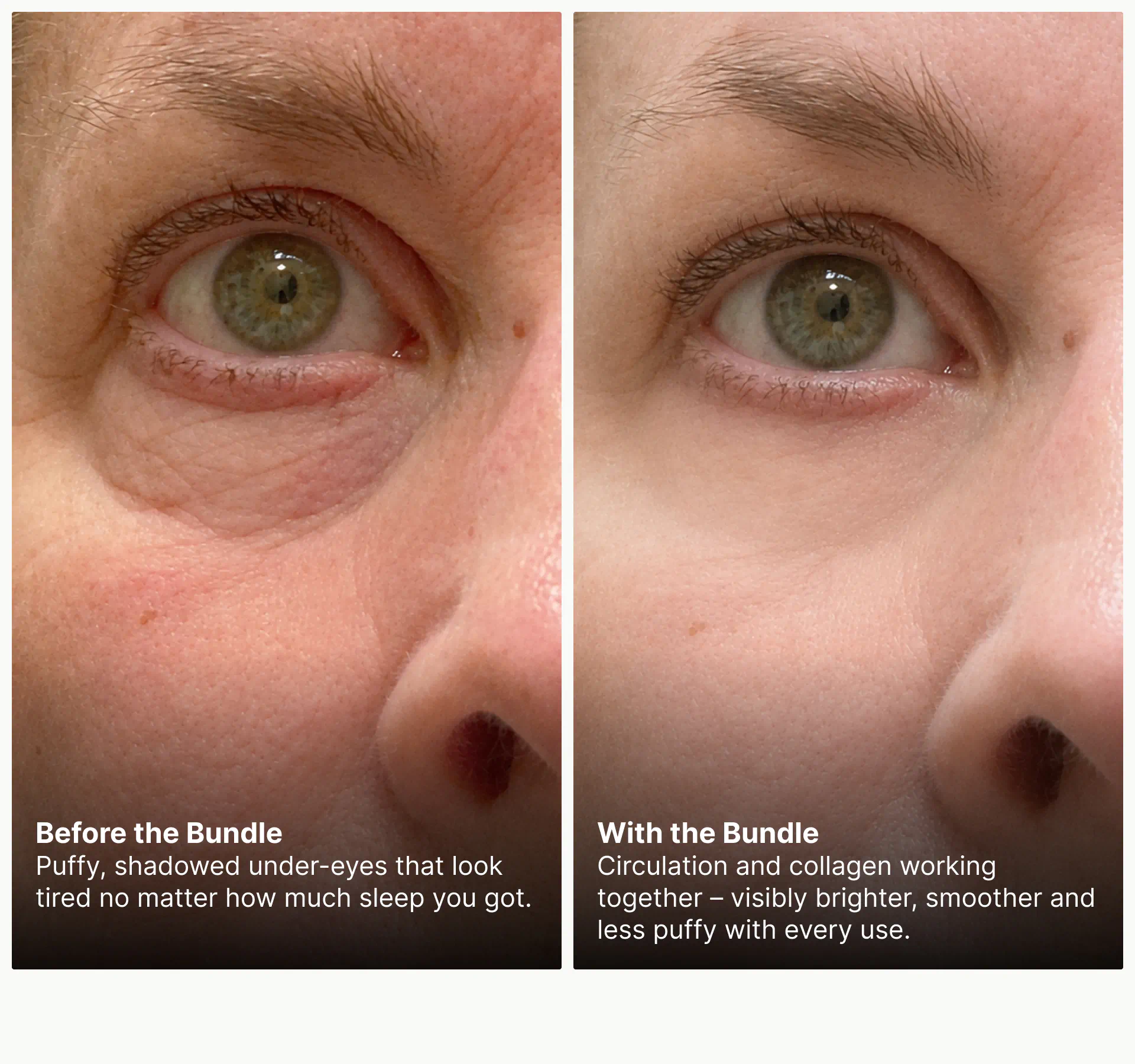 Before and after comparison for brighter, less puffy under-eyes