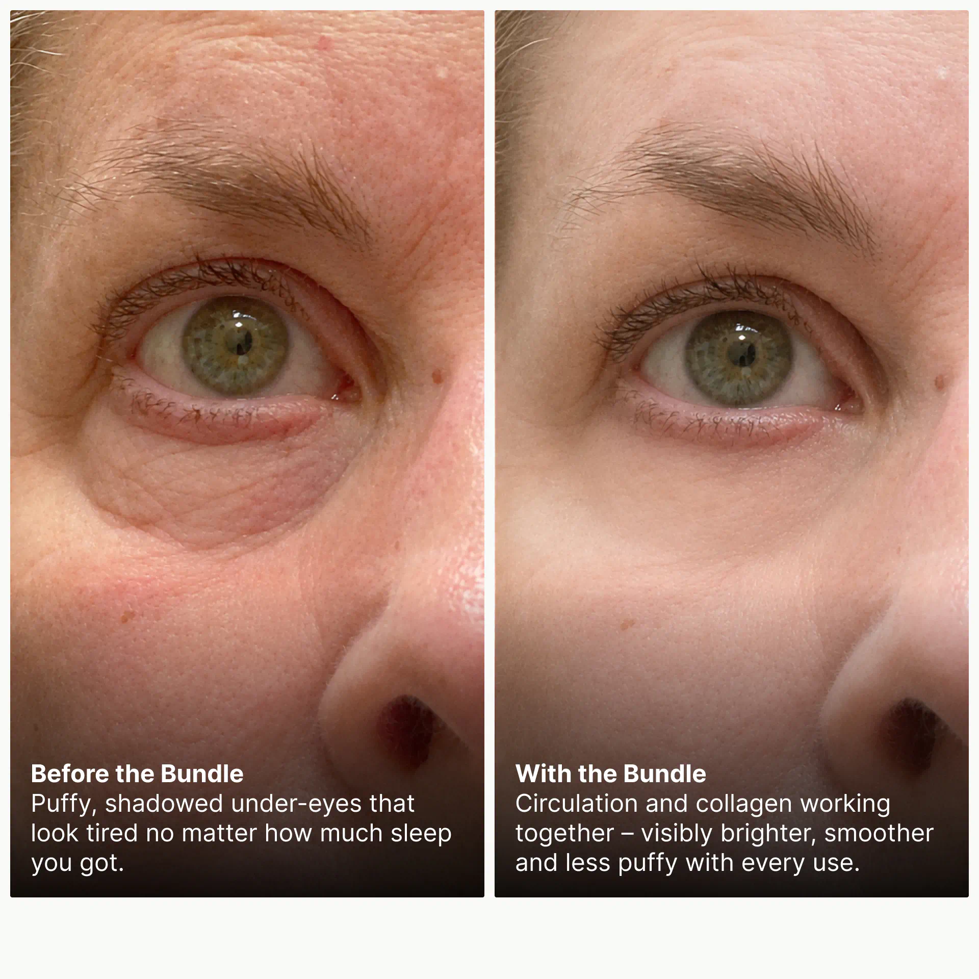 Before and after comparison for brighter, less puffy under-eyes